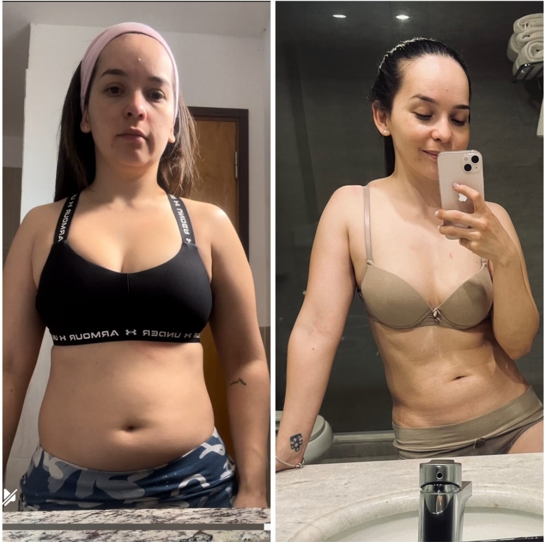Transformación Caso 1
